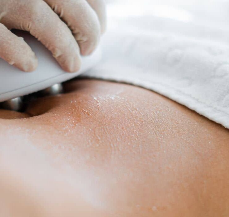 mh_skin_dermatology_sp_nomedoservico_sectum_radiofrequencia (2)