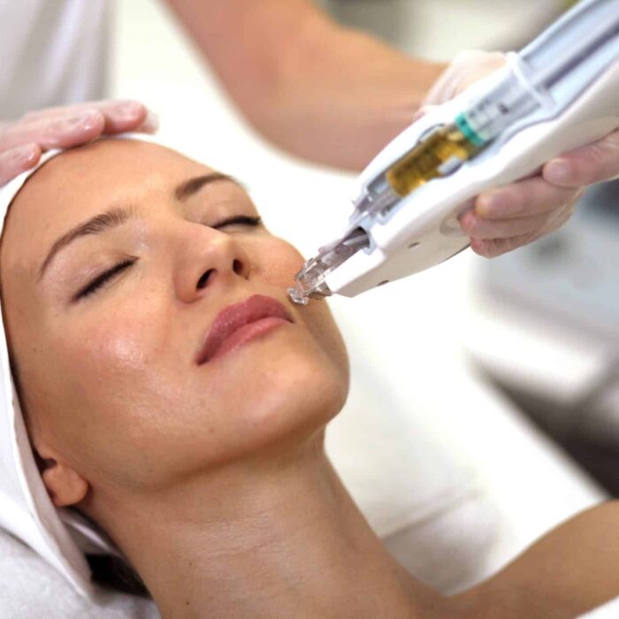 Mesoject